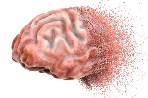 Graphic illustration of a seemingly unhealthy brain slowly disintegrating
